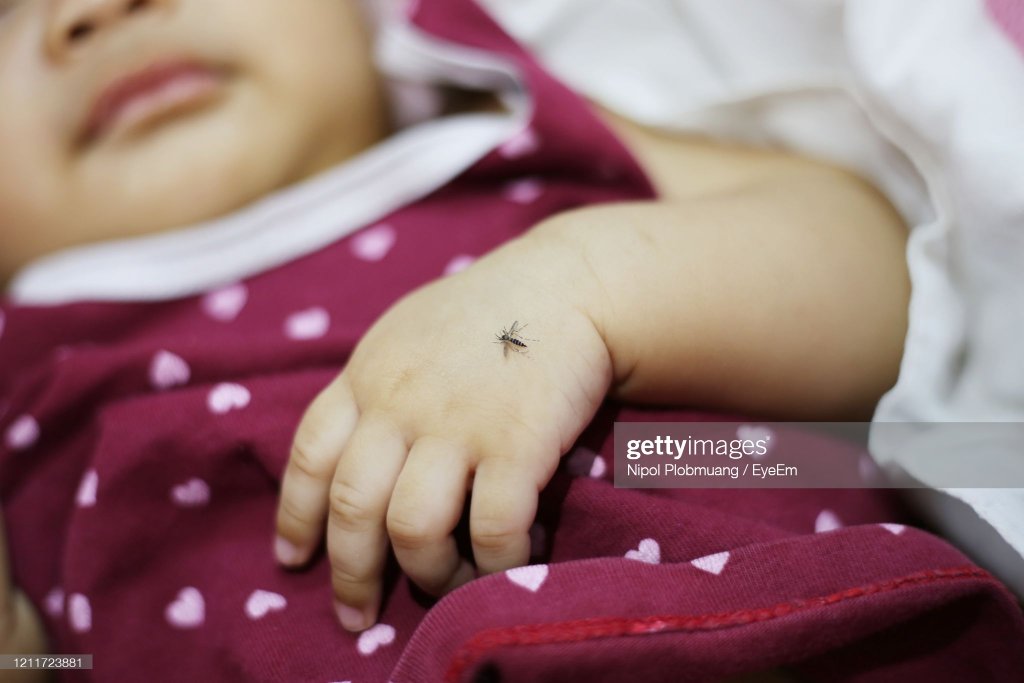 ملیریا کا مچھر بچی کے ہاتھ پر